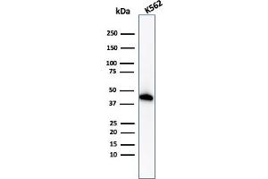Western Blot Analysis of K562 cell lysate using Glycophorin A Rabbit Recombinant Monoclonal Antibody (GYPA/1725R). (Recombinant CD235a/GYPA anticorps)