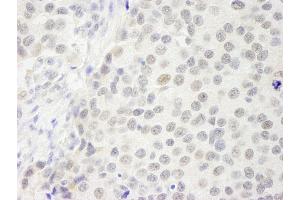 Immunohistochemistry (IHC) image for anti-GATA Zinc Finger Domain Containing 2B (GATAD2B) (AA 50-100) antibody (ABIN7448709) (GATAD2B anticorps  (AA 50-100))
