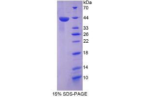 Image no. 1 for TP53 Target 5 (TP53TG5) (AA 190-262) protein (His tag) (ABIN6239146)
