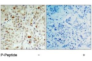 Image no. 2 for anti-Retinoblastoma 1 (RB1) (pSer807) antibody (ABIN196841) (Retinoblastoma 1 anticorps  (pSer807))