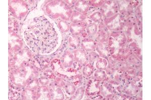 Human Kidney: Formalin-Fixed, Paraffin-Embedded (FFPE) (G Protein-Coupled Receptor 133 anticorps  (Cytoplasmic Domain))