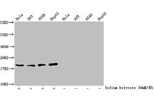 Western Blot Detected samples: Hela whole cell lysate, 293 whole cell lysate, A549 whole cell lysate, HepG2 whole cell lysate, Untreated (-) or treated (+) with 30 mM sodium butyrate for 4h All lanes: HIST1H1C antibody at 2. (HIST1H1C anticorps  (acLys84))