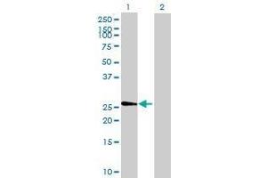 Lane 1: FIGLA transfected lysate ( 24. (FIGLA 293T Cell Transient Overexpression Lysate(Denatured))