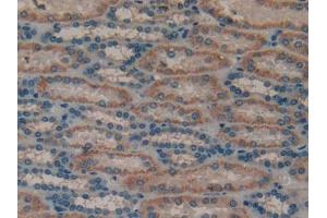 DAB staining on IHC-P; Samples: Human Kidney Tissue (MUC1 anticorps  (AA 1098-1255))