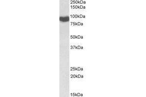 AP21520PU-N CYPOR antibody staining of Rat Liver lysate at 0.