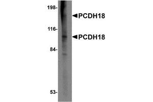 Western Blotting (WB) image for anti-Protocadherin 18 (PCDH18) (N-Term) antibody (ABIN1031506) (PCDH18 anticorps  (N-Term))