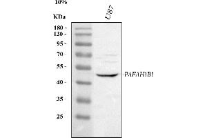 Western blot analysis of LIS1/PAFAH1B1 using anti-LIS1/PAFAH1B1 antibody (ABIN7602688).