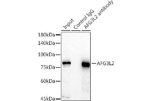Immunoprecipitation analysis of 300 μg extracts of HeLa cells using 3 μg L2 antibody (ABIN7265513). (AFG3L2 anticorps  (AA 538-797))