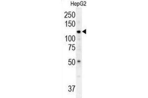 Western Blotting (WB) image for anti-ATPase Type 13A3 (ATP13A3) antibody (ABIN3002493) (ATP13A3 anticorps)