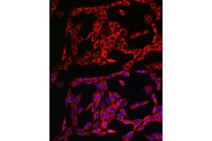 Immunofluorescence analysis of PC-12 cells using FGFR3 Rabbit pAb (ABIN1679839, ABIN3015135, ABIN3015137 and ABIN6213838) at dilution of 1:100 (40x lens).
