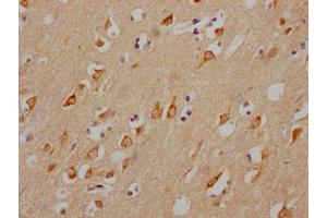 IHC image of ABIN7127632 diluted at 1:100 and staining in paraffin-embedded human brain tissue performed on a Leica BondTM system.