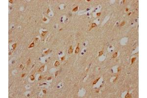 IHC image of ABIN7127632 diluted at 1:100 and staining in paraffin-embedded human brain tissue performed on a Leica BondTM system. (Recombinant CHRM3 anticorps)