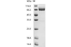 Interleukin 2 Receptor, alpha (IL2RA) (AA 22-236) protein (hFc Tag)