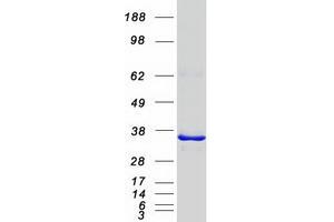 Validation with Western Blot