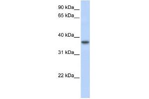 TMEM173 antibody used at 1 ug/ml to detect target protein. (STING/TMEM173 anticorps  (Middle Region))