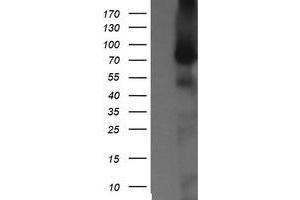 Image no. 1 for anti-NIMA (Never In Mitosis Gene A)-Related Kinase 11 (NEK11) antibody (ABIN1499682) (NEK11 anticorps)