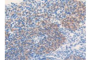 IHC-P analysis of Mouse Ovary Tissue, with DAB staining. (MGST1 anticorps  (AA 8-155))