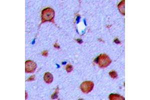 Immunohistochemical analysis of GLP-1 Receptor staining in human brain formalin fixed paraffin embedded tissue section.