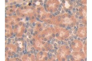 Detection of SEMA3A in Rat Kidney Tissue using Polyclonal Antibody to Semaphorin 3A (SEMA3A)