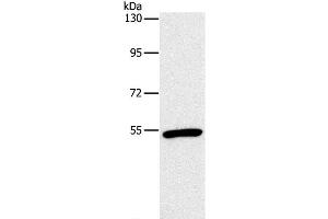 Western Blot analysis of Mouse heart tissue using OXTR Polyclonal Antibody at dilution of 1:866 (Oxytocin Receptor anticorps)