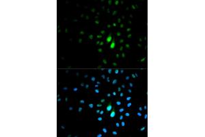 Immunofluorescence analysis of MCF-7 cells using PIN1 antibody. (PIN1 anticorps)