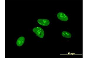 Immunofluorescence of monoclonal antibody to PKNOX1 on HeLa cell.