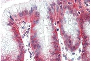 Human, Stomach: Formalin-Fixed Paraffin-Embedded (FFPE)