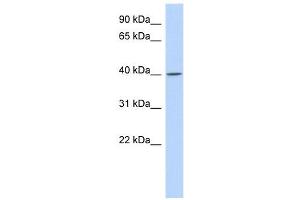 C11ORF65 antibody used at 1 ug/ml to detect target protein. (C11orf65 anticorps  (N-Term))