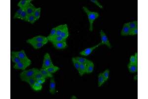 Immunofluorescence staining of HepG2 cells with ABIN7143973 at 1:100, counter-stained with DAPI.