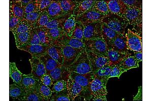 Immunocytochemistry staining of clathrin in human HeLa cell line using anti-clathrin (BF-06, green).