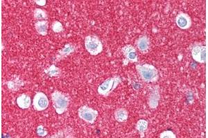 Human Brain, Cortex (formalin-fixed, paraffin-embedded) stained with NCAM1 antibody ABIN239829 at 10 ug/ml followed by biotinylated anti-mouse IgG secondary antibody ABIN481714, alkaline phosphatase-streptavidin and chromogen. (CD56 anticorps)