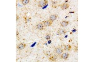 Immunohistochemical analysis of PACAP-R1 staining in human brain formalin fixed paraffin embedded tissue section. (ADCYAP1R1 anticorps)