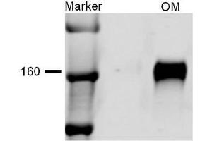 Western blot analysis of Rat kidney tissue lysates showing detection of NKCC2 protein using Rabbit Anti-NKCC2 Polyclonal Antibody . (SLC12A1 anticorps  (AA 33-55) (PE))