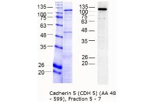 Western Blotting (WB) image for Cadherin 5 (CDH5) (AA 48-599) protein (MBP tag) (ABIN3090342) (Cadherin 5 Protein (CDH5) (AA 48-599) (MBP tag))