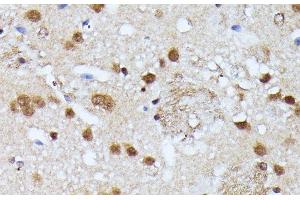 Immunohistochemistry of paraffin-embedded Mouse brain using KIAA1429 Polyclonal Antibody at dilution of 1:100 (40x lens). (VIRMA/KIAA1429 anticorps)