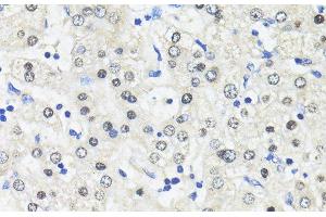 Immunohistochemistry of paraffin-embedded Human liver using TRIM27 Polyclonal Antibody at dilution of 1:100 (40x lens). (TRIM27 anticorps)