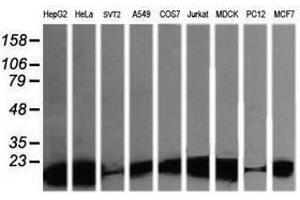 Image no. 9 for anti-Leucine Zipper and CTNNBIP1 Domain Containing (LZIC) antibody (ABIN1499239)