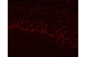 IF analysis of HnRNP H/HNRNPH1 using anti-HnRNP H/HNRNPH1 antibody (ABIN4886623). (HNRNPH1 anticorps  (N-Term))