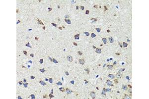 Immunohistochemistry of paraffin-embedded Mouse brain using CCDC124 Polyclonal Antibody at dilution of 1:100 (40x lens). (CCDC124 anticorps)