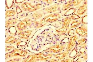 IHC image of ABIN7156316 diluted at 1:300 and staining in paraffin-embedded human kidney tissue performed on a Leica BondTM system. (OCRL anticorps  (AA 121-271))