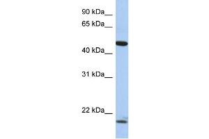 WB Suggested Anti-PLAGL1 Antibody Titration:  0. (PLAGL1 anticorps  (N-Term))