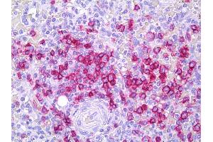 Anti-CD45RB antibody IHC of human spleen, lymphocytes. (CD45RB anticorps  (FITC))