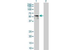 Lane 1: IRX6 transfected lysate ( 48. (IRX6 293T Cell Transient Overexpression Lysate(Denatured))