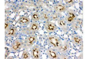 Anti- SMC3 Picoband antibody, IHC(P) IHC(P): Rat Kidney Tissue (SMC3 anticorps  (C-Term))