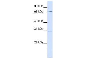 OR6C75 antibody used at 1 ug/ml to detect target protein. (OR6C75 anticorps  (Middle Region))
