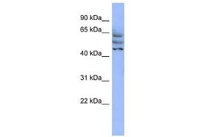 C3ORF19 antibody used at 1 ug/ml to detect target protein. (CCDC174 anticorps  (Middle Region))