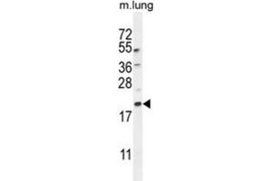 Western Blotting (WB) image for anti-APG8a,b antibody (ABIN2995751) (APG8a,b anticorps)
