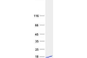 Validation with Western Blot