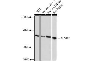 Western blot analysis of extracts of various cell lines, using  Rabbit mAb (ABIN7265412) at 1:1000 dilution. (ACVRL1 anticorps)