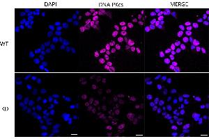 Immunocytochemical staining of Hela cells using DNA PKcs antibody (ABIN7800013), 1:1,000), Top panel: wild-type (WT), Bottom panal: DNA PKcs shRNA knockdown (KD). (Recombinant PRKDC anticorps)